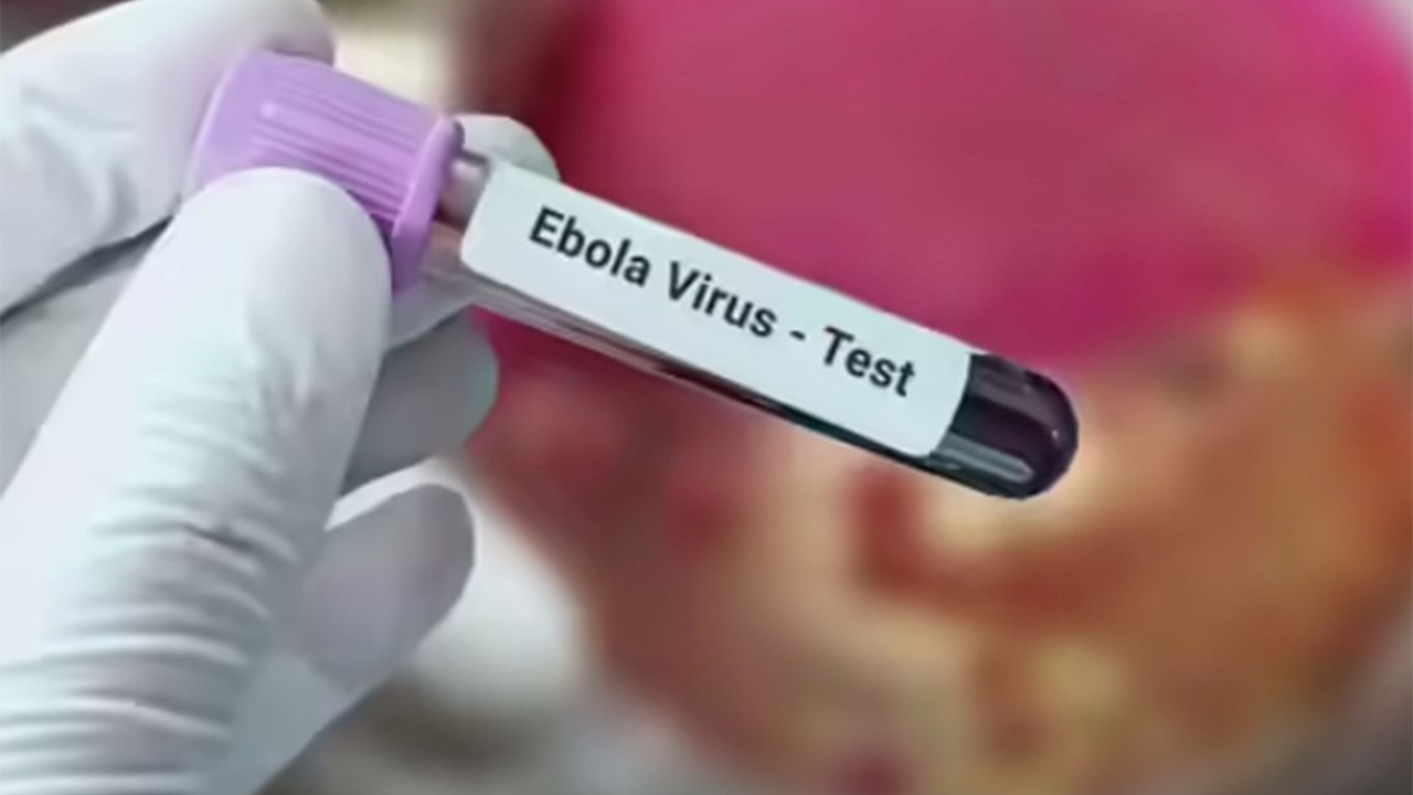 Avrupa'da ölümcül virüs alarmı! Fransa'da ilk Ebola vakası resmen açıklandı