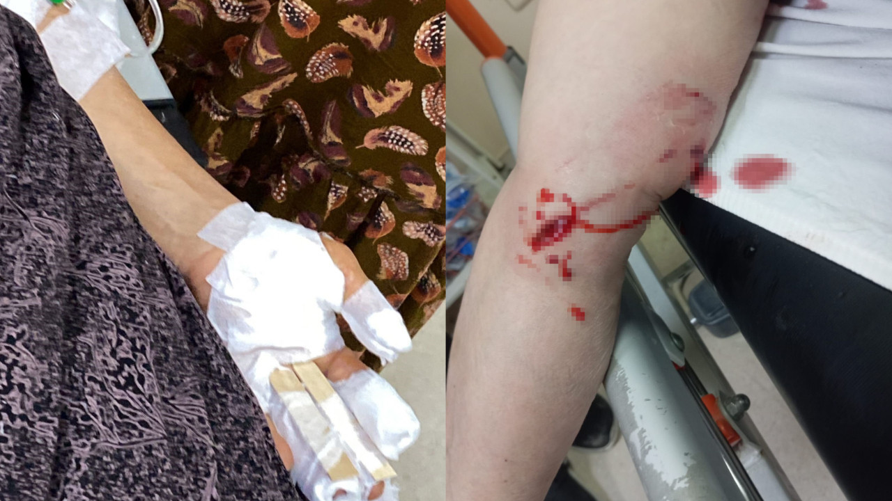 Mahallede dehşet anları: Başıboş köpekler kadınlara saldırdı